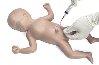 Baby Umbi (cathétérisme ombilical)